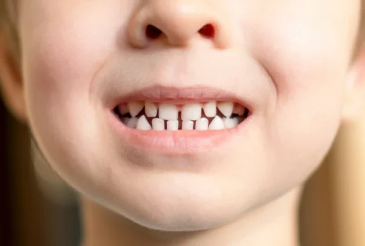 Spazi fra i denti