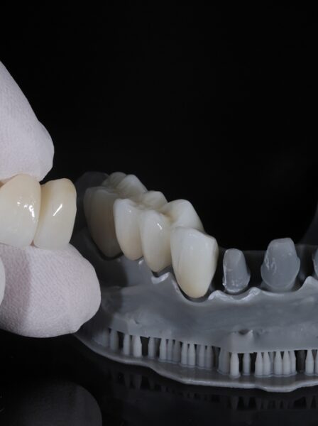 Corone in zirconio