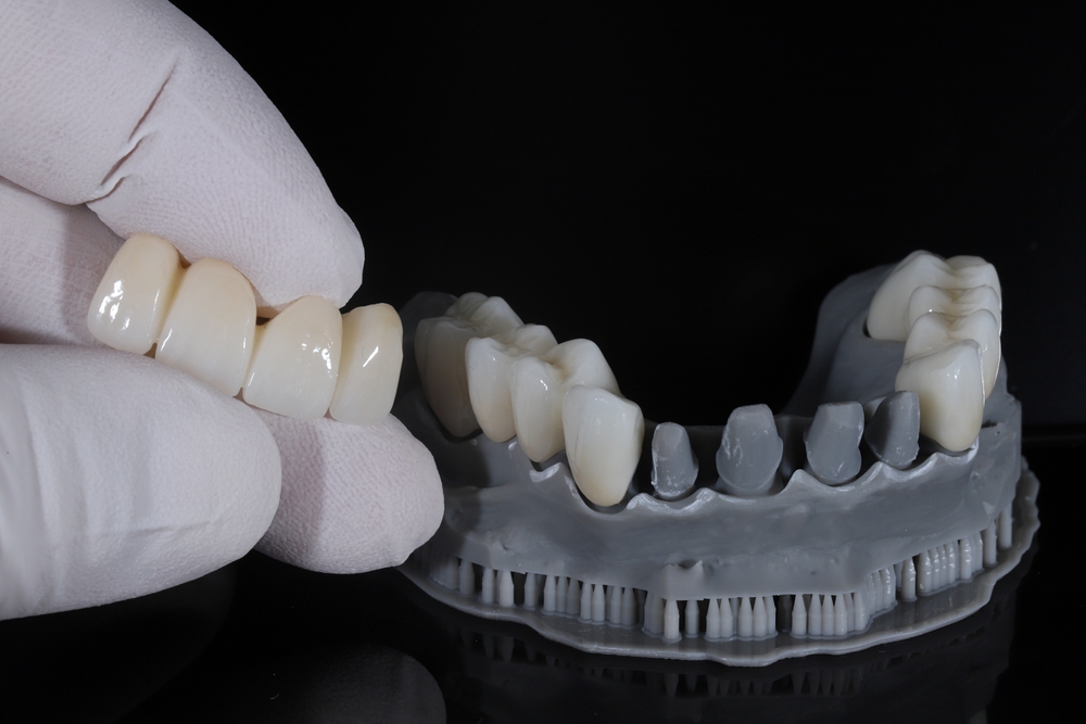Corone in zirconio 1 Corone in zirconio