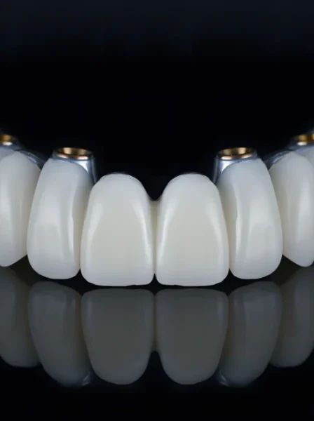 arcata dentaria